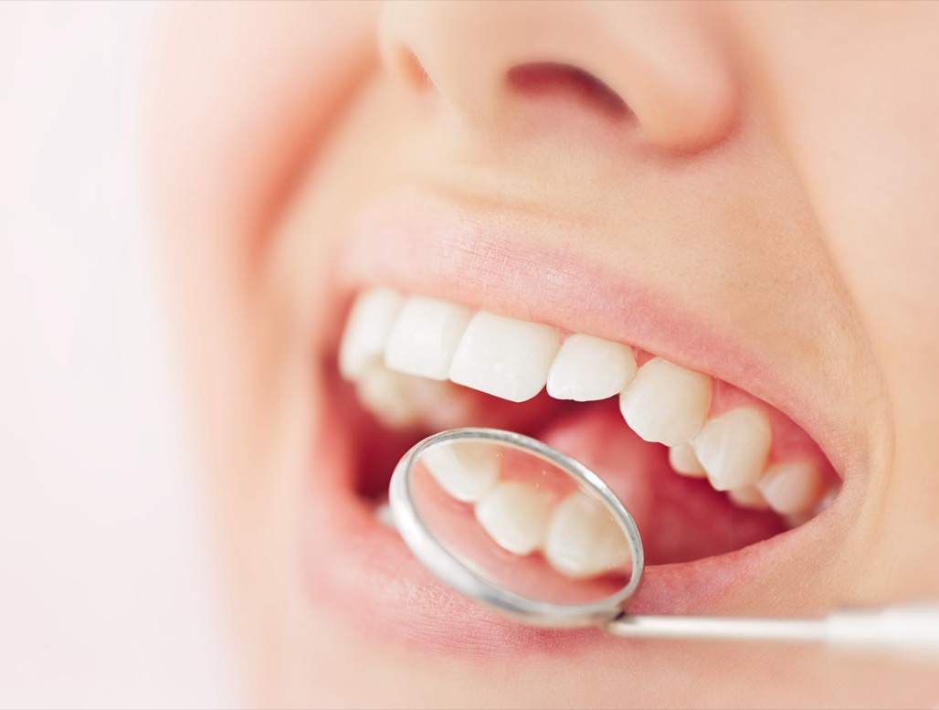 Routine Dental Care Treatments Near Me in Litchfield